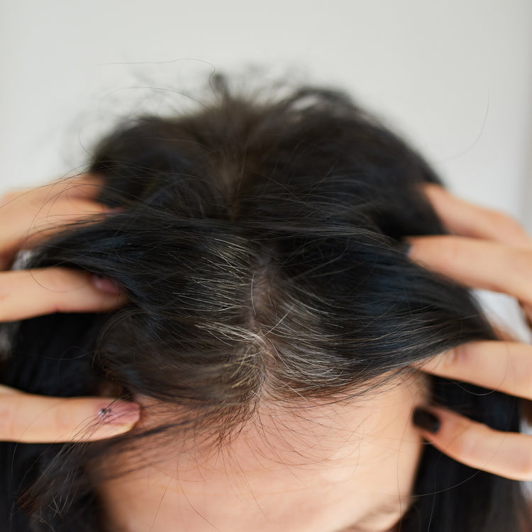 Scalp Issues