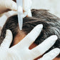 Scalp No Needle Mesotherapy Package